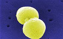 Streptococcus pneumoniae (Archiv), &uuml;ber dts Nachrichtenagentur
